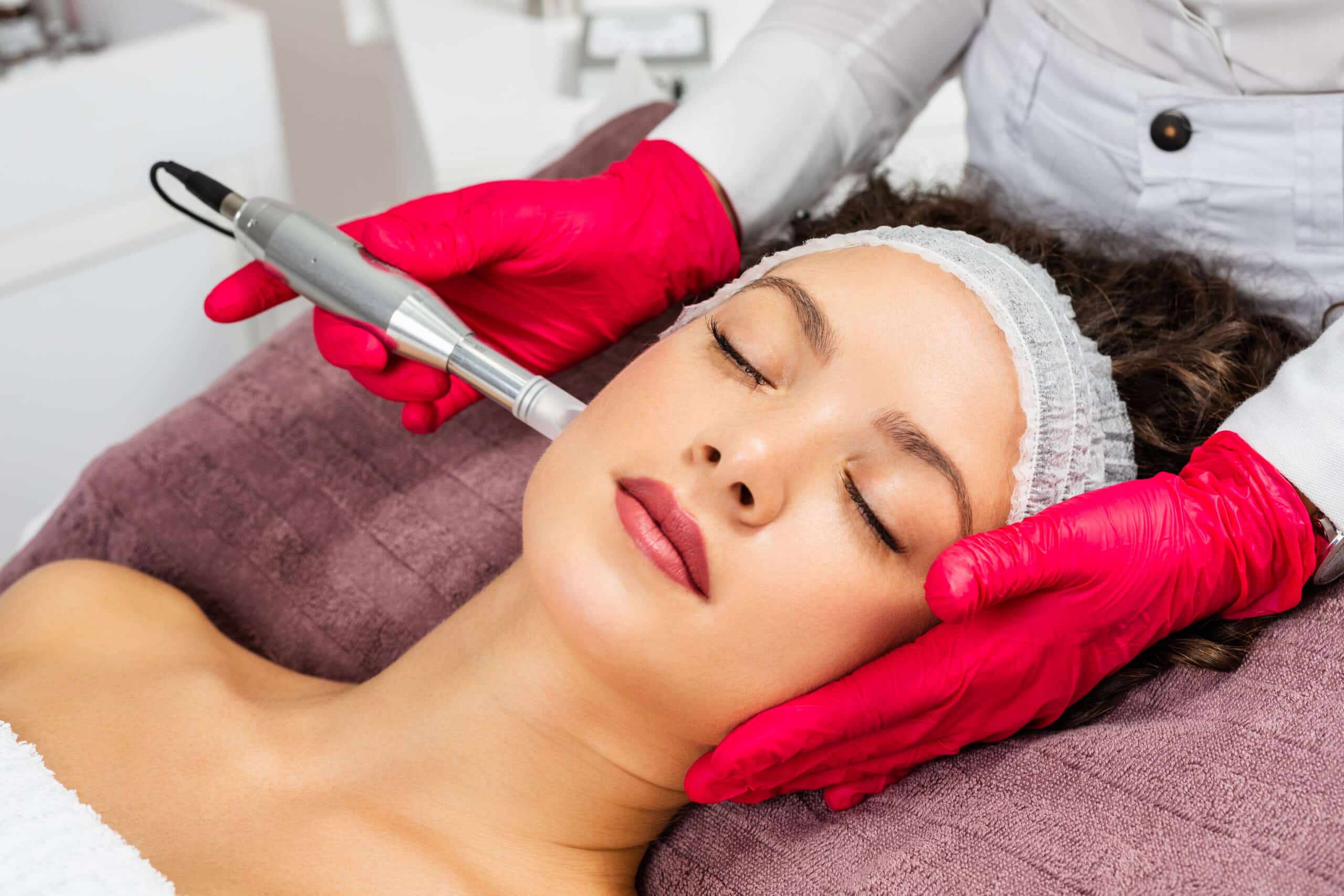 Microneedling The Ultimate Guide to Rejuvenate Your Skin